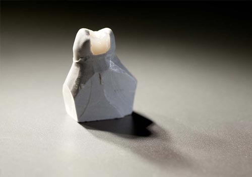 Konservierende Behandlung